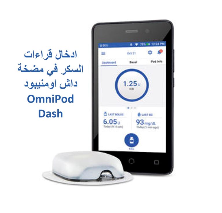 ادخال قياس السكر مضخة اومنيبود داش OmniPod