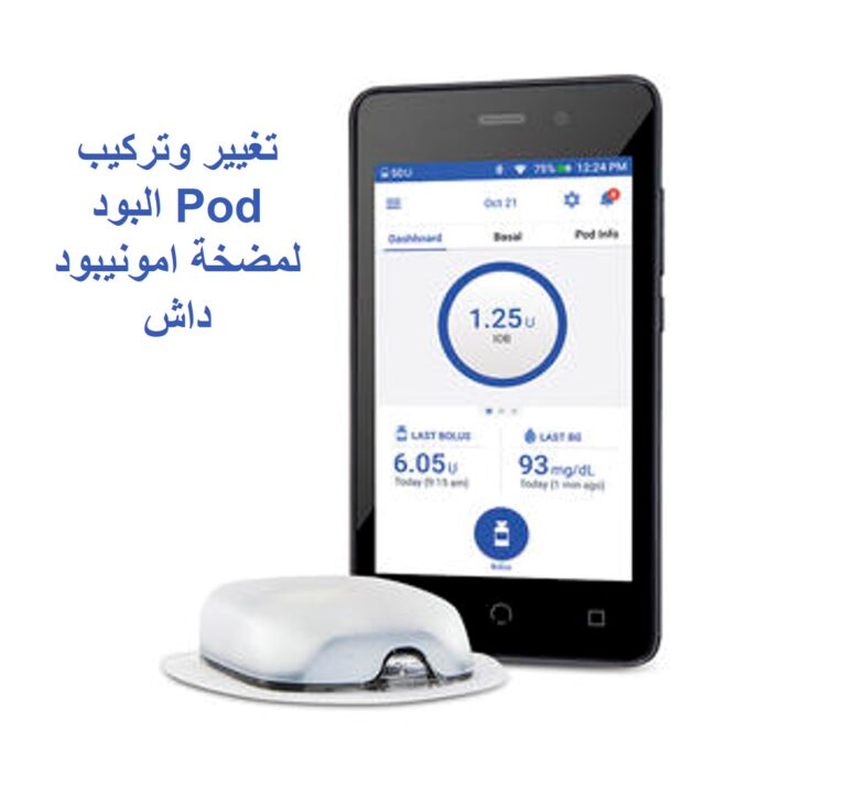 تركيب البود pod لمضخة اومنيبود داش OmniPod